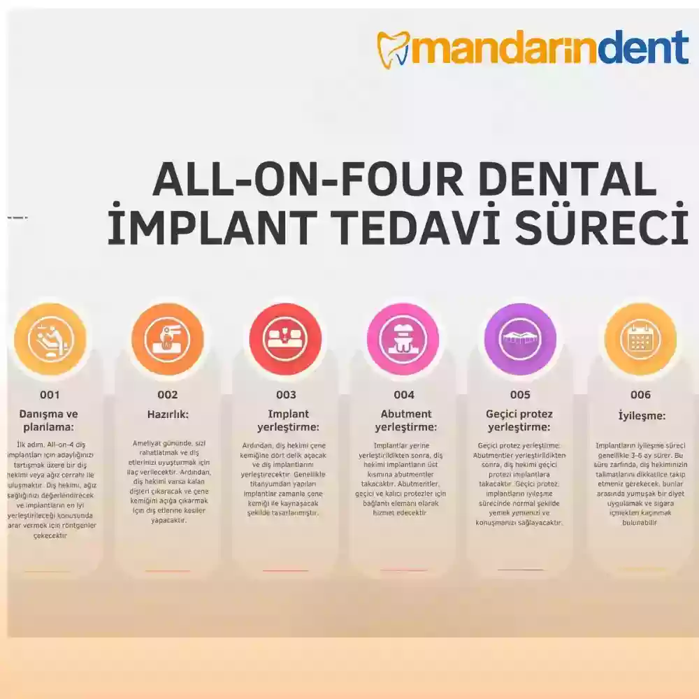 All-on-Four Tedavisi Nasıl Yapılır? – Muayene, görüntüleme, implant yerleştirme ve protez aşamaları