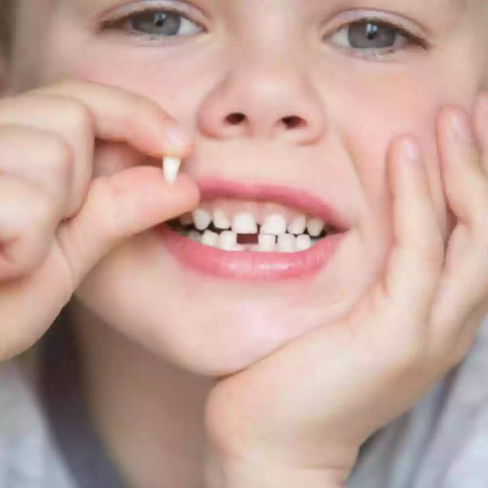 Bodrum Pediatric Dentistry (Pedodontics) - Primary tooth extraction procedure