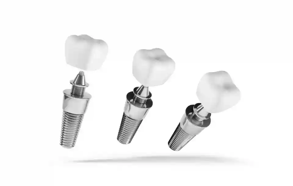 Bodrum Dental Implant Treatments: Permanent Solutions for Missing Teeth - Implant Bridge