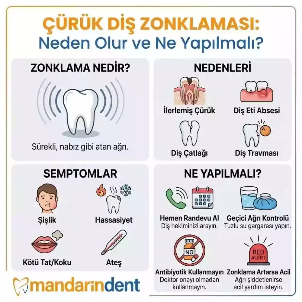 Zonklayan diş ağrısına ne iyi gelir, nedenleri ve tedavisi – Çürük diş zonklaması
