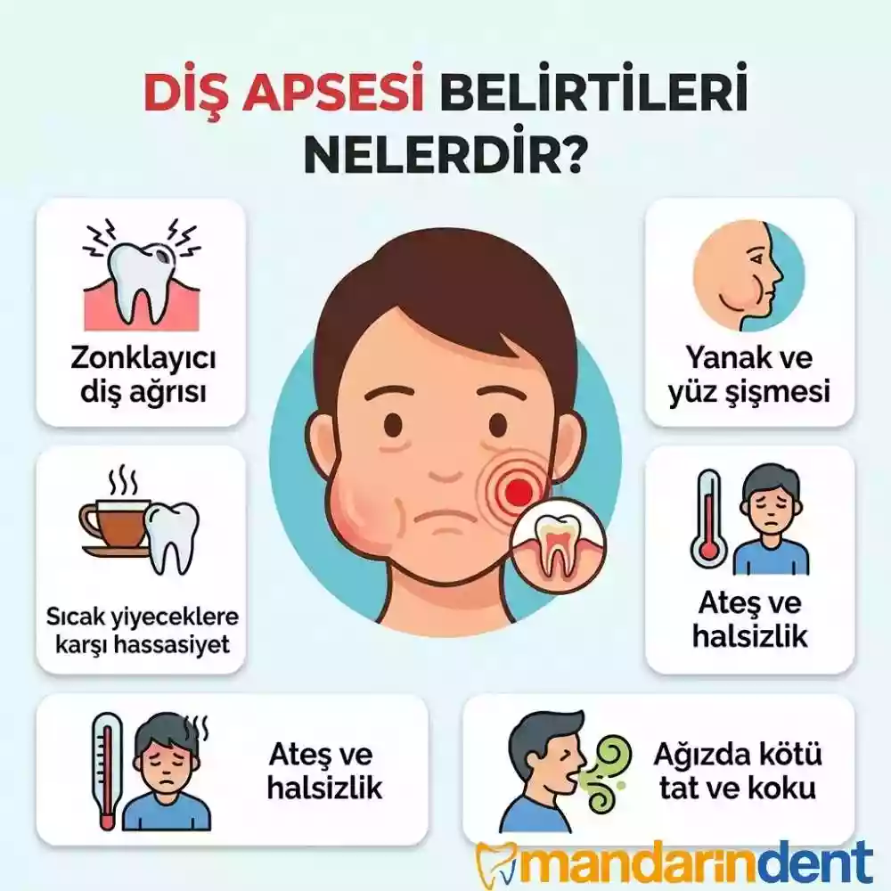 Diş Apsesi Belirtileri Nelerdir
