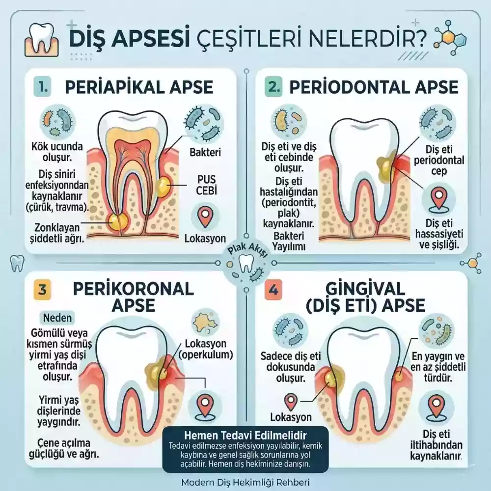 Diş Apsesi Çeşitleri Nelerdir?