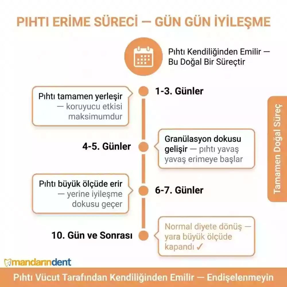 Diş çekimi sonrası pıhtı ne zaman düşer – pıhtının çözülme süreci