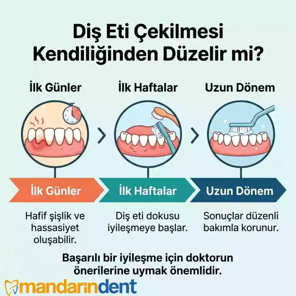 Diş Eti Çekilmesi Kendiliğinden Düzelir mi?