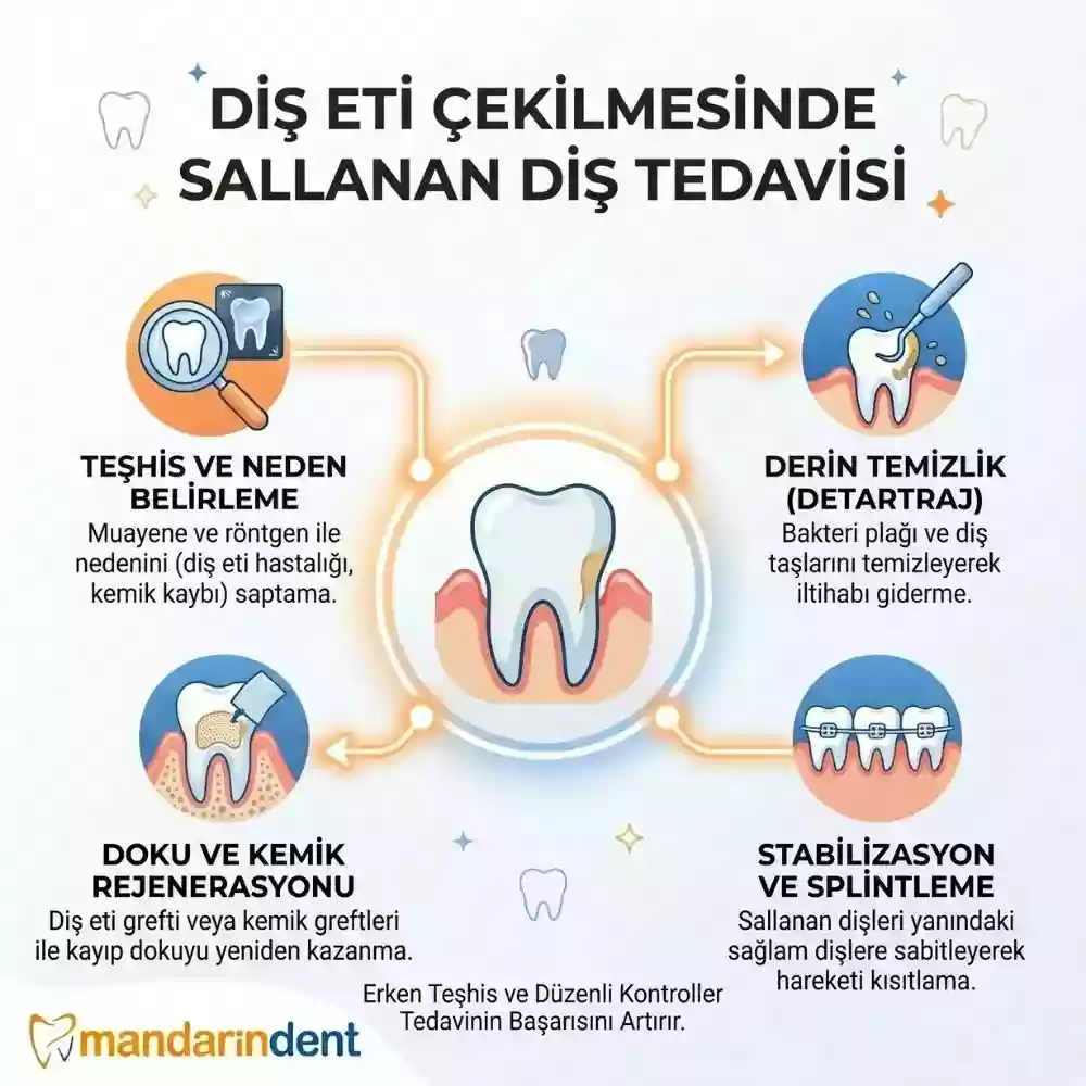 Sallanan diş tedavisi, ne zaman çekilir – Diş eti çekilmesi