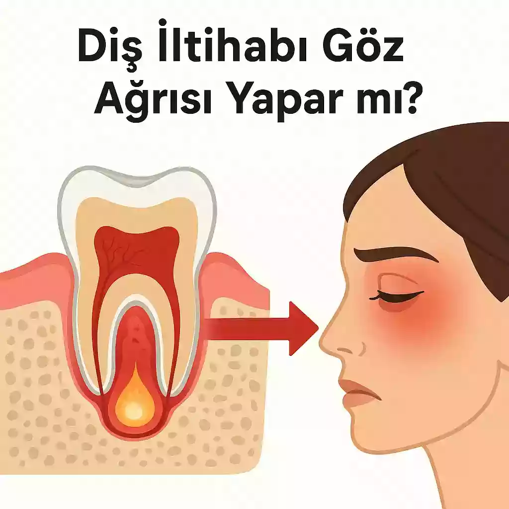 Diş İltihabı Göz Ağrısı Yapar mı? Diş ve göz çevresi ağrısı