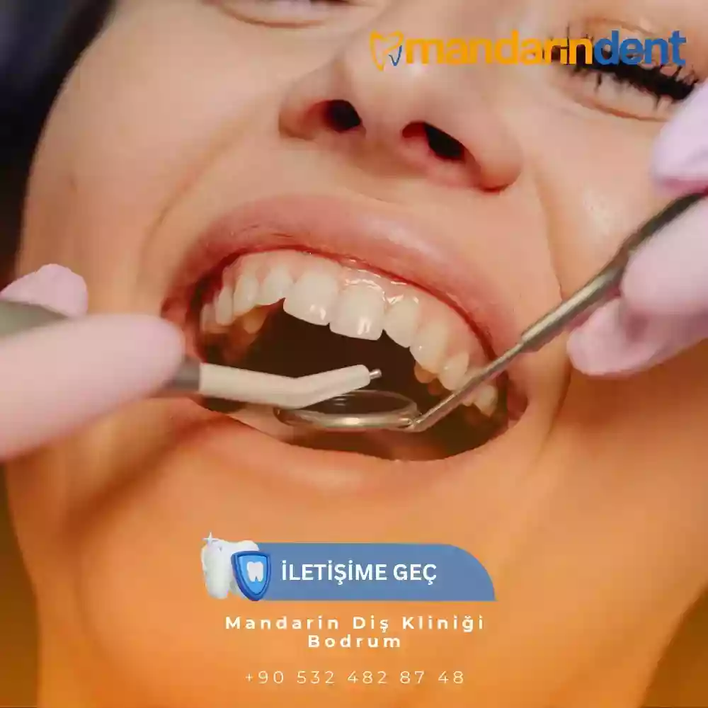 Diş Taşı Temizliği Acıtır mı? – Titreşim, hassasiyet ve ağrı kontrolü