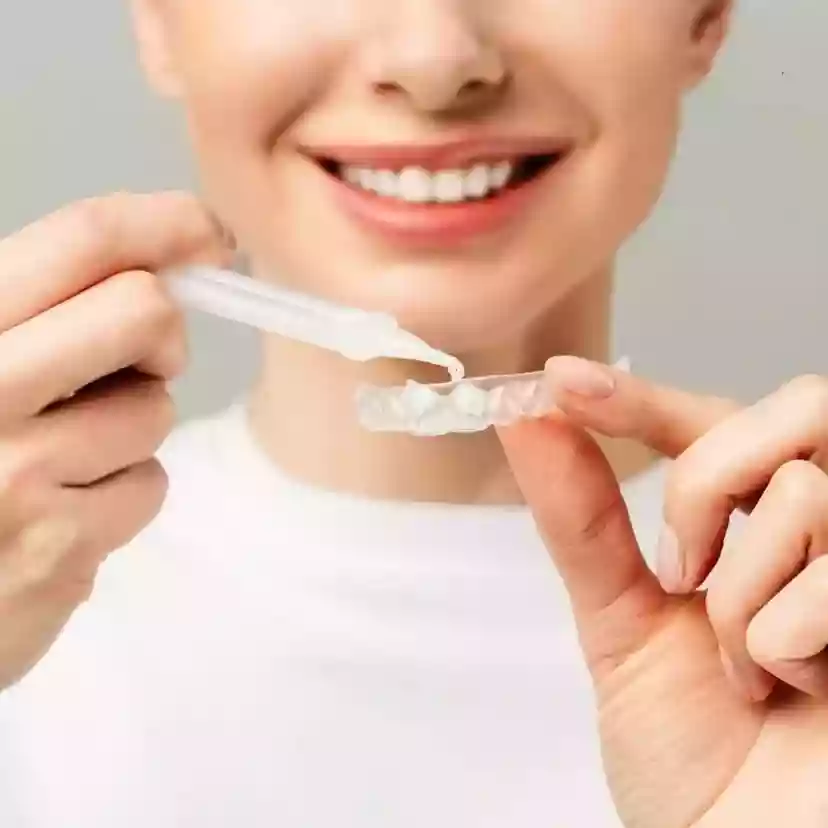 Bodrum Teeth Whitening (Bleaching) custom whitening trays