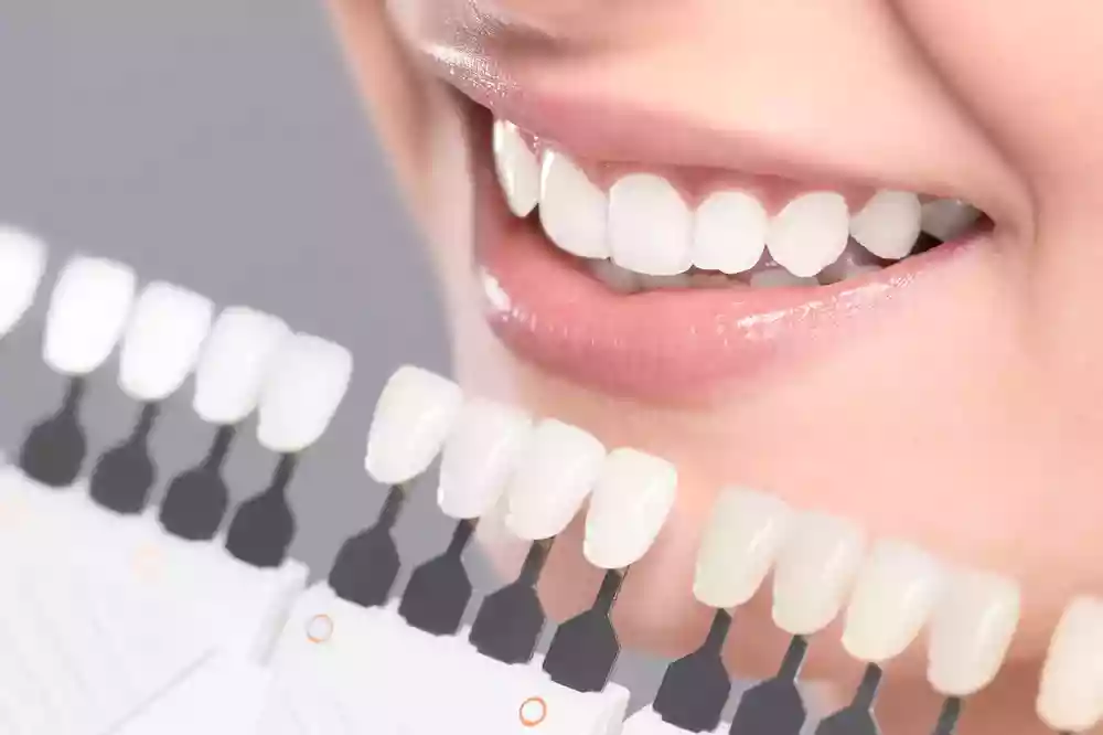 Bodrum dental prosthesis treatments – temporary prosthesis application