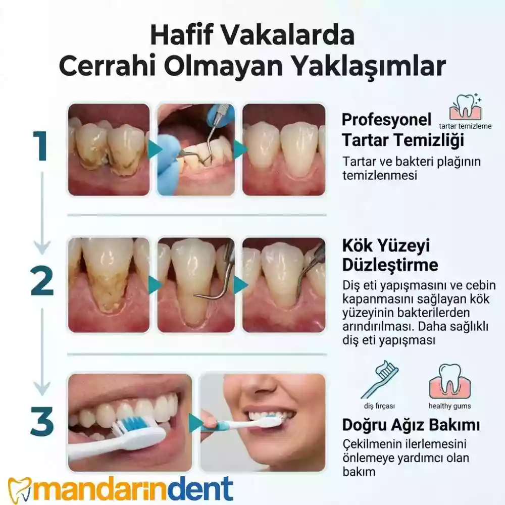 Hafif Vakalarda Cerrahi Olmayan Yaklaşımlar