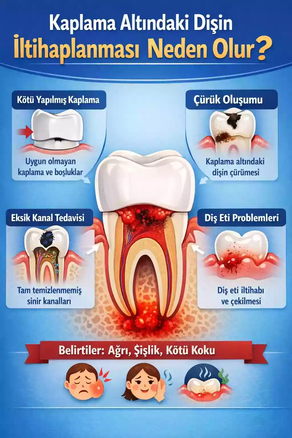 Kaplama altındaki dişin iltihaplanması – Neden olur?