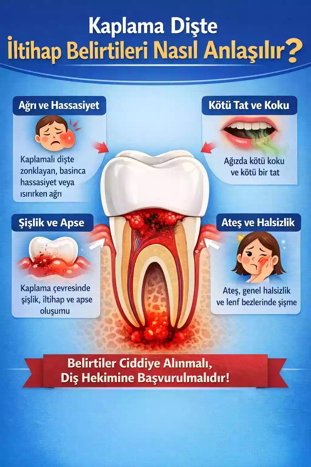 Kaplama altındaki dişin iltihaplanması – Belirtiler