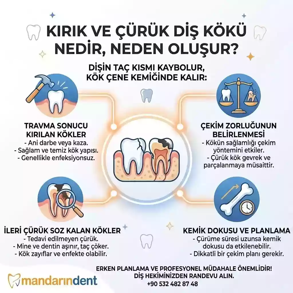 Kırık ve Çürük Diş Kökü Nedir, Neden Oluşur?