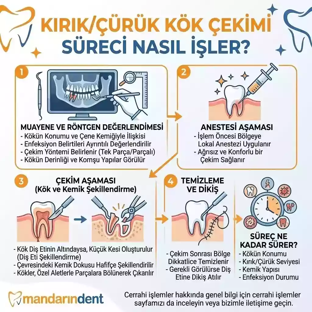 Kırık/Çürük Kök Çekimi Süreci Nasıl İşler?