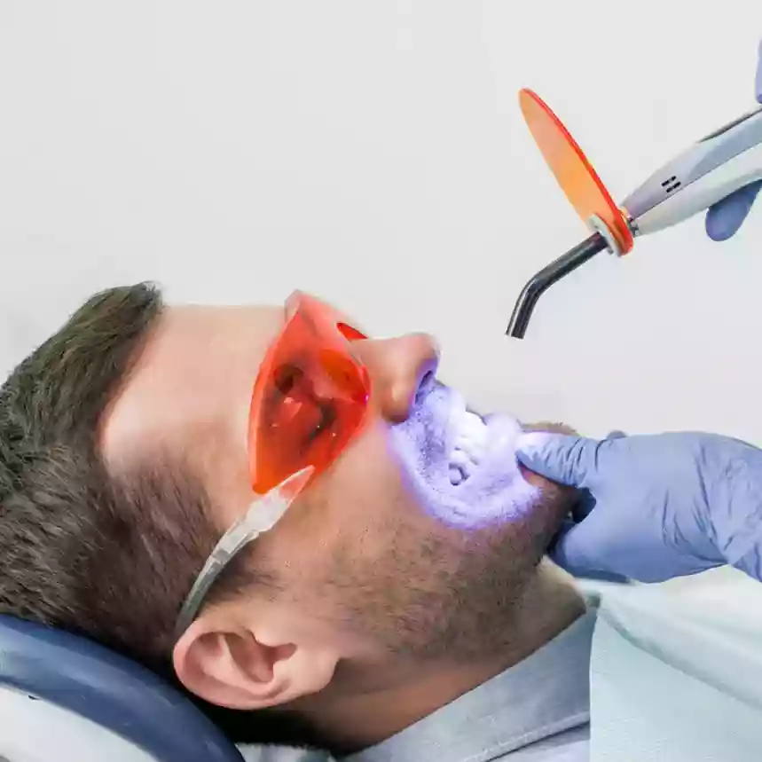 Bodrum Teeth Whitening (Bleaching) laser application in clinic
