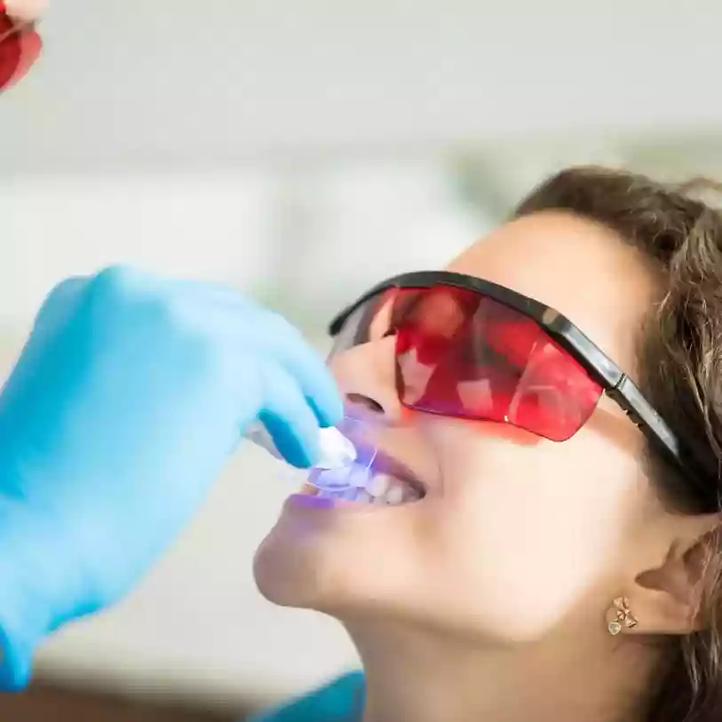 Bodrum Teeth Whitening (Bleaching) in-office whitening treatment