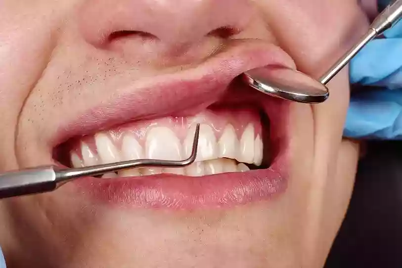 Bodrum Gum Diseases and Treatments periodontal curettage and surgery