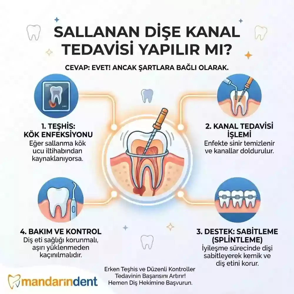 Sallanan diş tedavisi, ne zaman çekilir – Kanal tedavisi