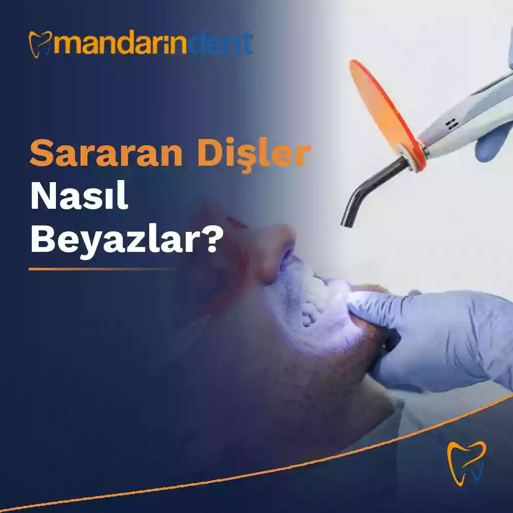 Sararan Dişler Nasıl Beyazlar? – Diş sararması nedenleri ve doğru tedaviye ilk bakış