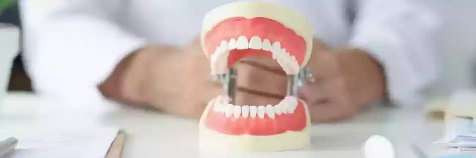 Bodrum Dental Implant Treatments: Permanent Solutions for Missing Teeth - All-on-4 / All-on-6
