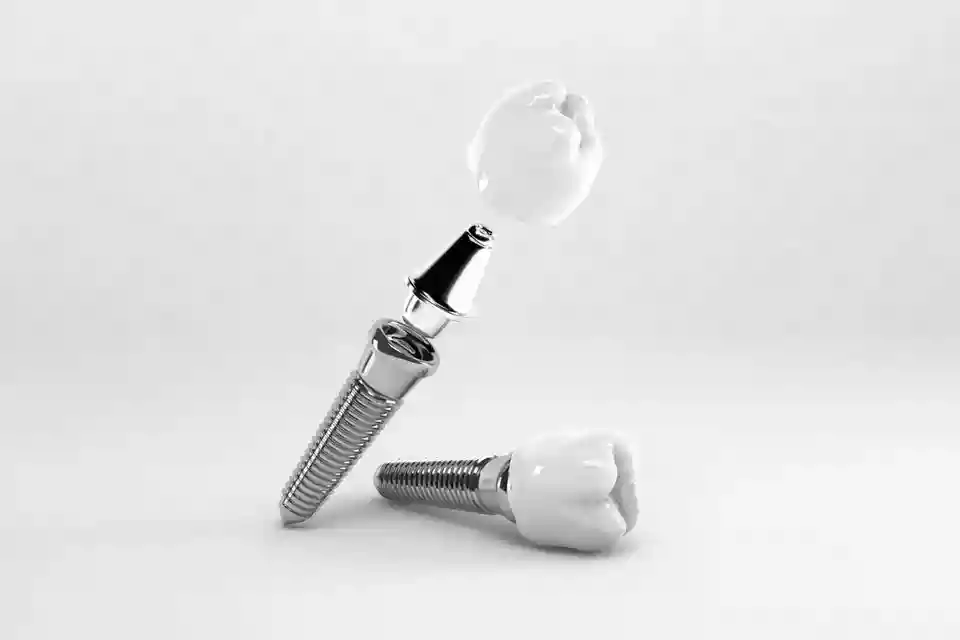 Bodrum Dental Implant Treatments: Permanent Solutions for Missing Teeth - Single Tooth Implant