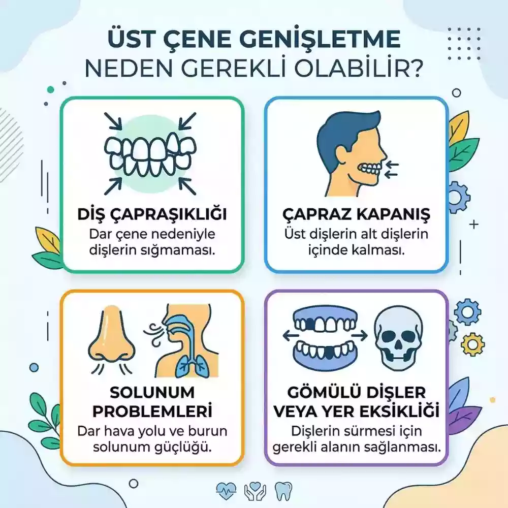 Üst çene genişletme neden gerekli olabilir, üst çene darlığı ve çapraz kapanış
