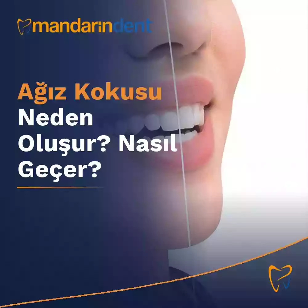 Ağız kokusu neden oluşur? Nasıl geçer? – halitozis belirtileri ve nedenleri