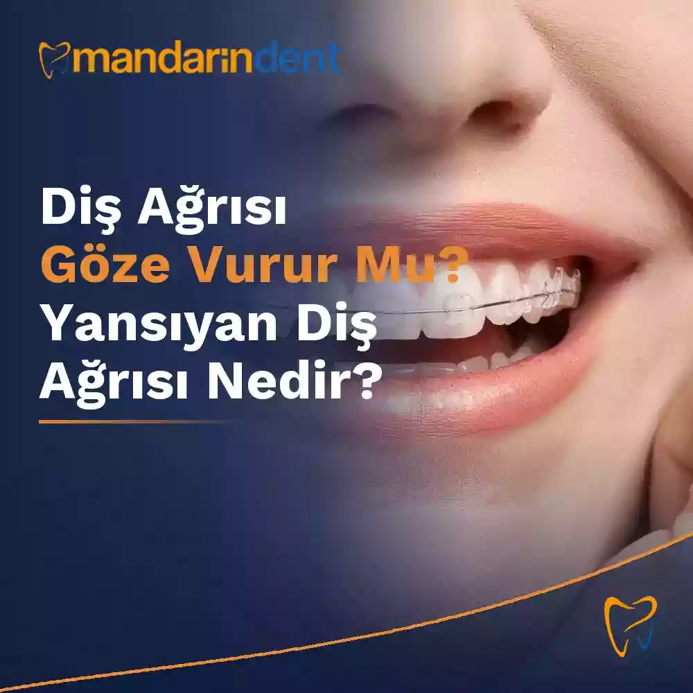 Diş Ağrısı Göze Vurur Mu? Yansıyan Diş Ağrısı Nedir? – Temel Görsel