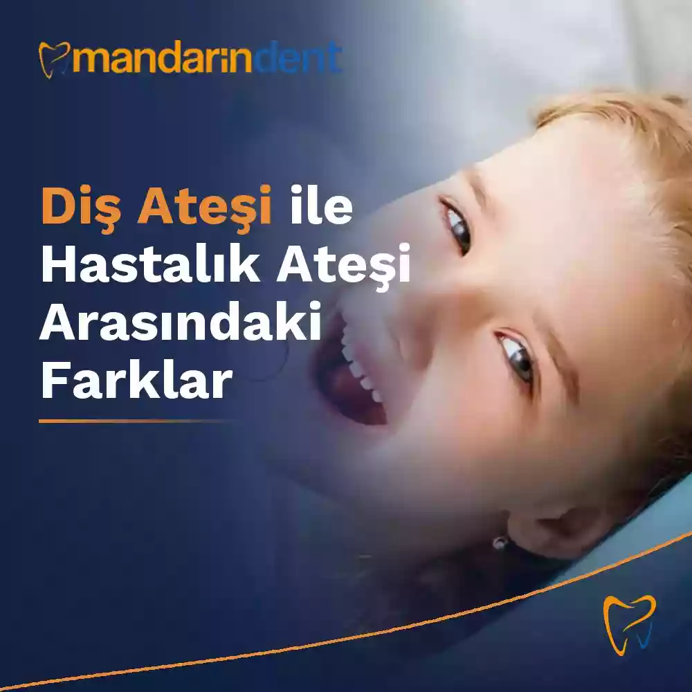 Diş Ateşi ile Hastalık Ateşi Arasındaki Farklar – Şematik Analiz