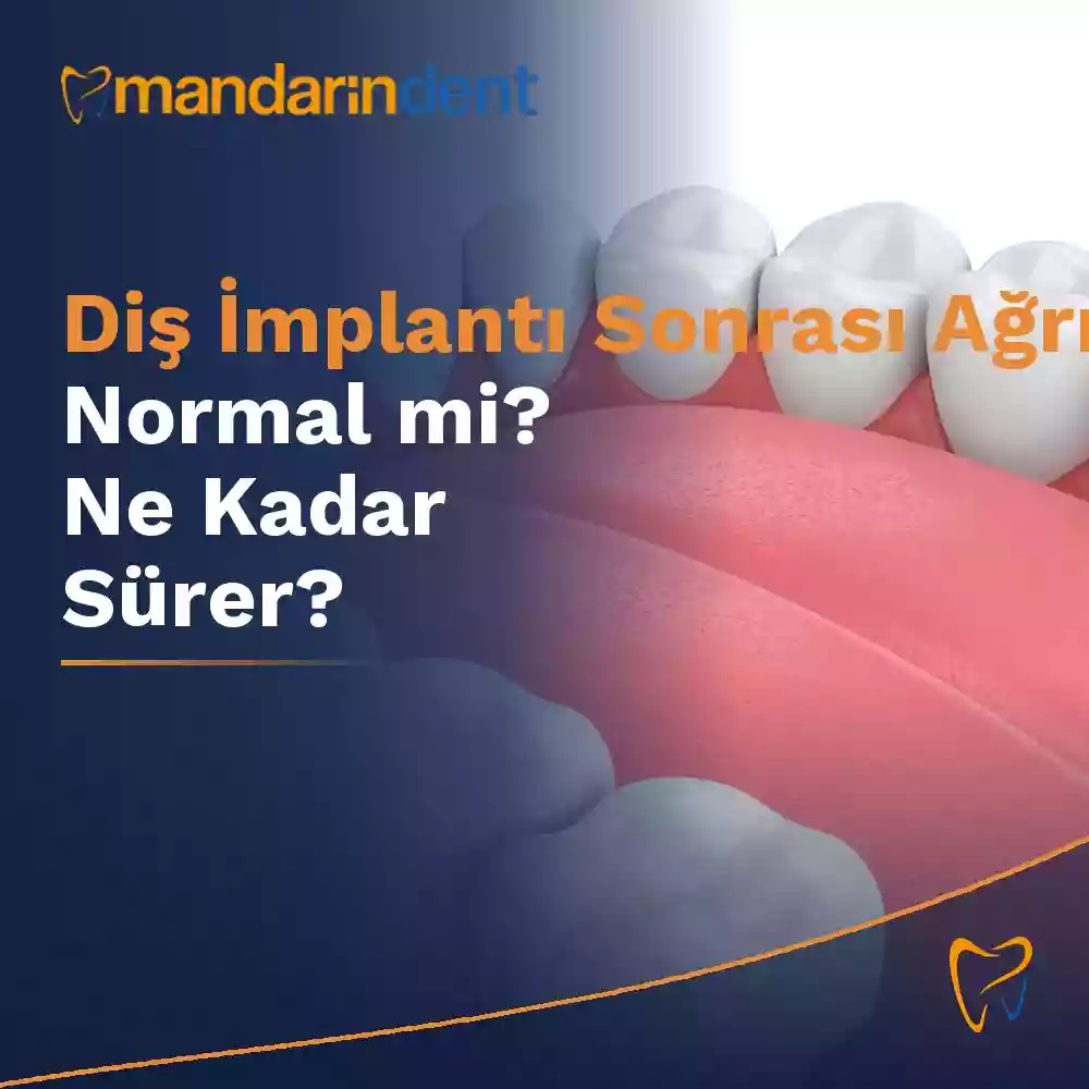 Diş implantı sonrası ağrı – implant sonrası ağrı