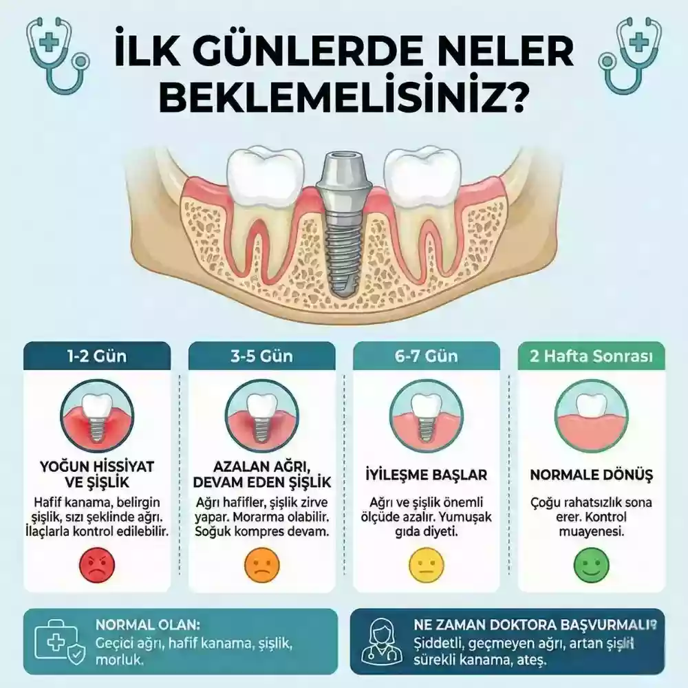 Diş implantı sonrası ağrı – implant sonrası ağrının azalması