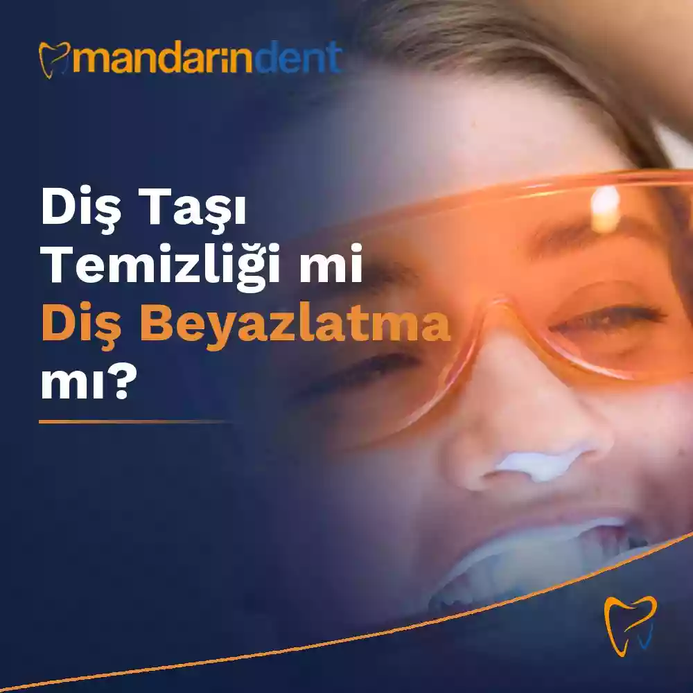 Diş Taşı Temizliği mi Diş Beyazlatma mı karşılaştırmalı görsel Diş Taşı Temizliği mi Diş Beyazlatma mı karşılaştırmalı görsel
