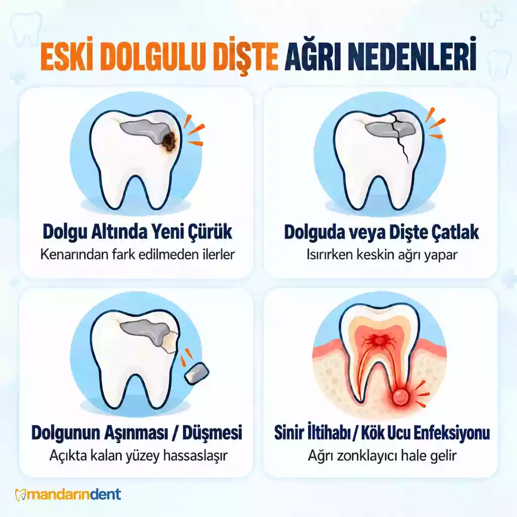 Dolgulu Diş Neden Ağrır? Yeni ve Eski Dolguda Ağrı – Eski Dolgu Nedenleri