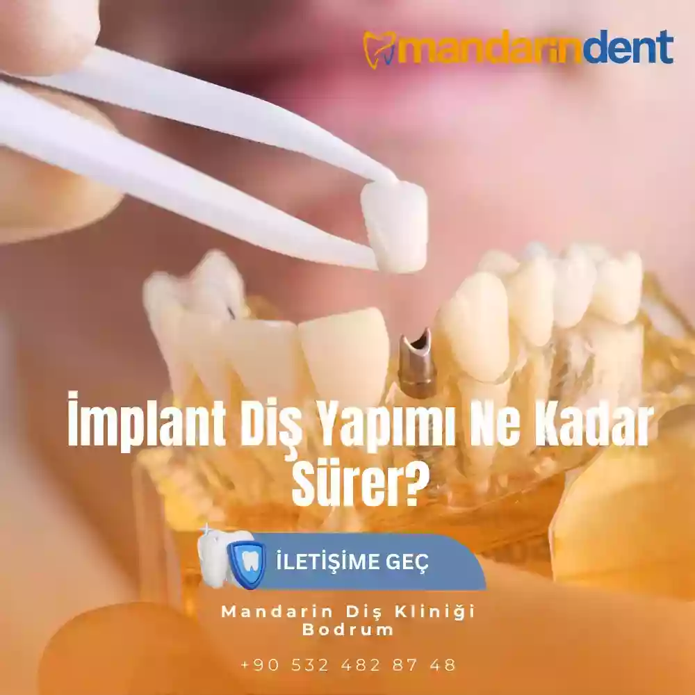 Genç yaşta implant yapılır mı – implant öncesi bekleme dönemi