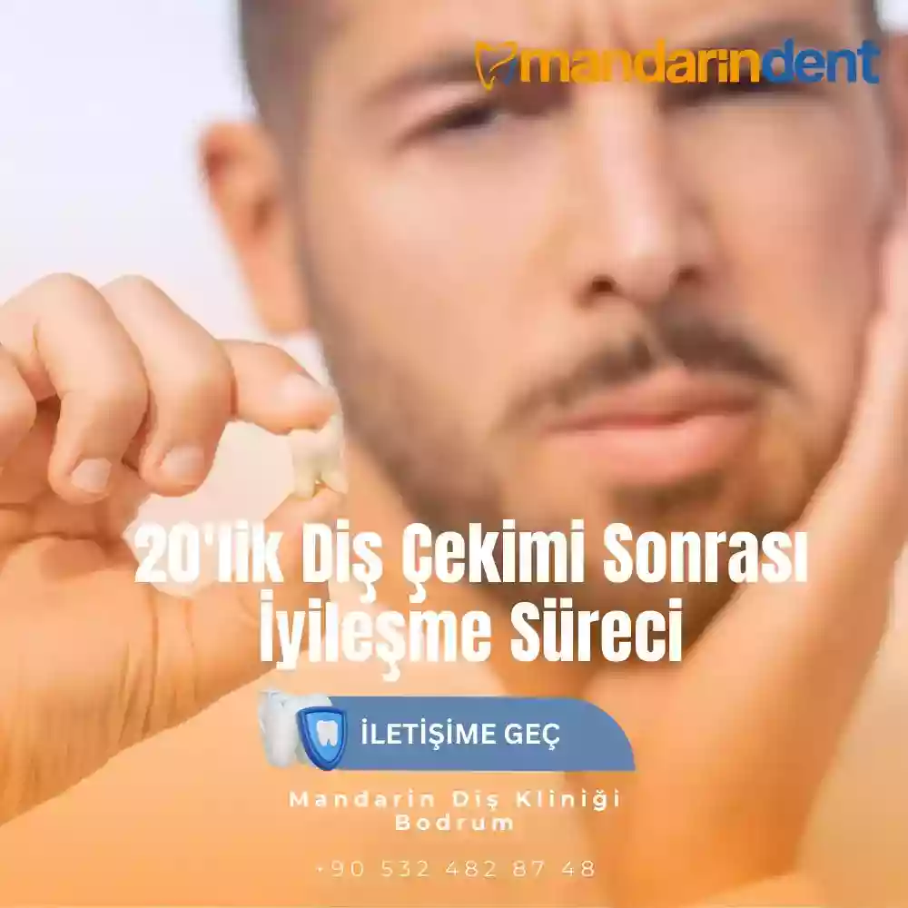 Genç yaşta implant yapılır mı – gelişim tamamlandıktan sonra implant süreci