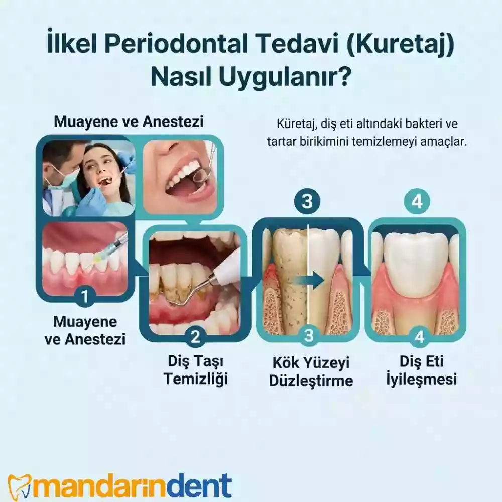 Periodontal Tedavi Nedir, Kimlere Uygulanır?