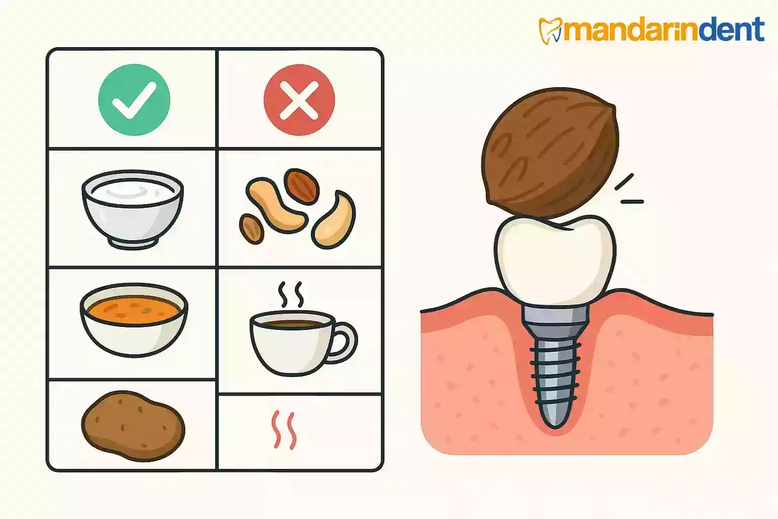İmplant diş takıldıktan sonra dikkat edilmesi gerekenler – implant sonrası beslenme