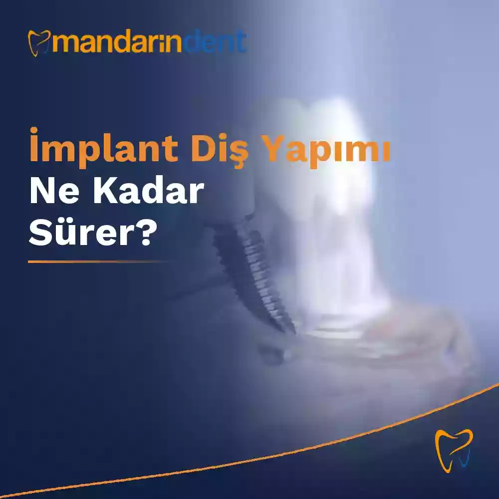İmplant diş yapımı ne kadar sürer – implant tedavi süresi