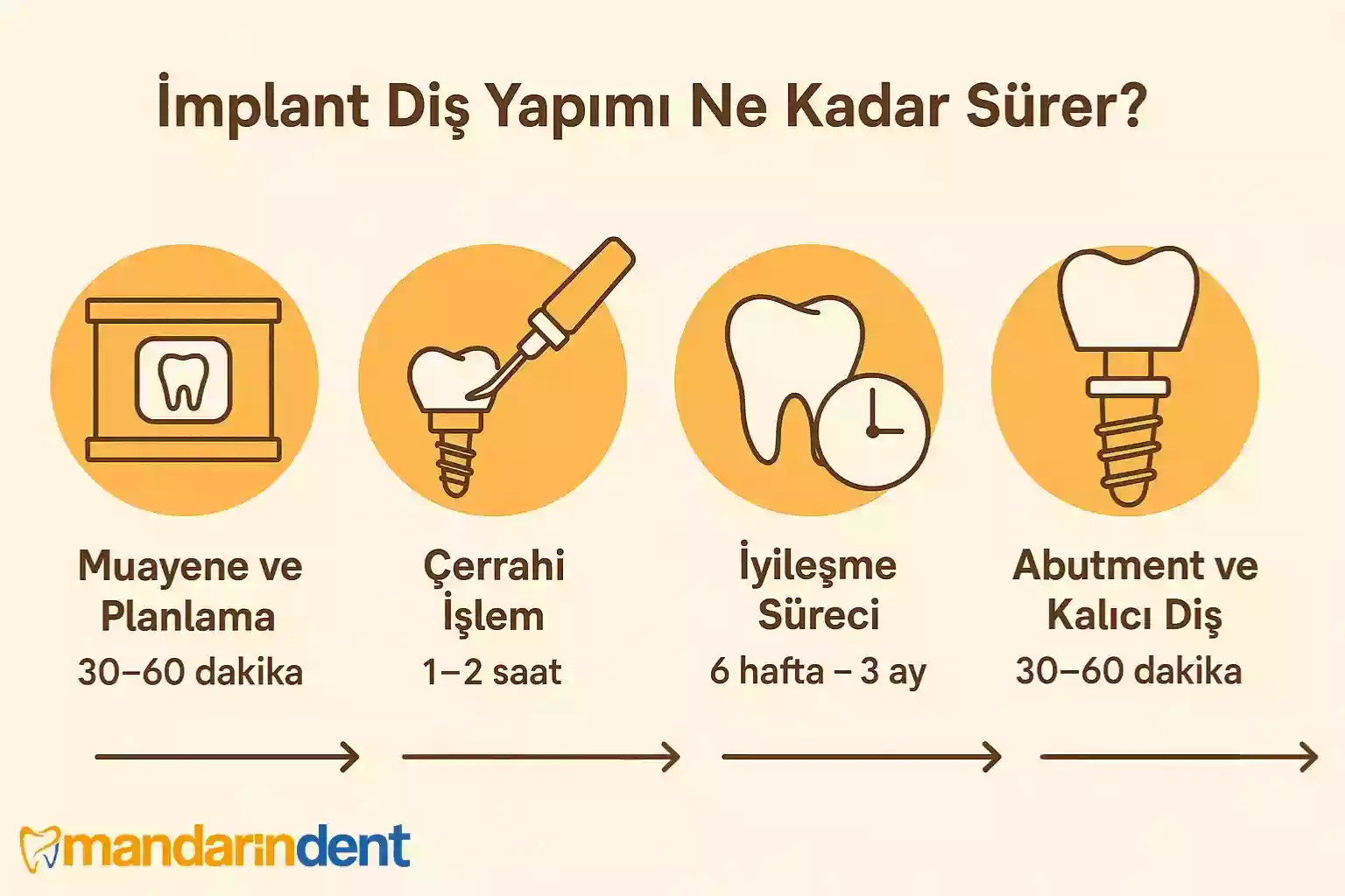 İmplant diş yapımı ne kadar sürer – implantın kemikle kaynaşması